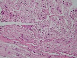 Peripheral nerve, cross section