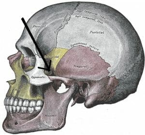 Zygomatic arch