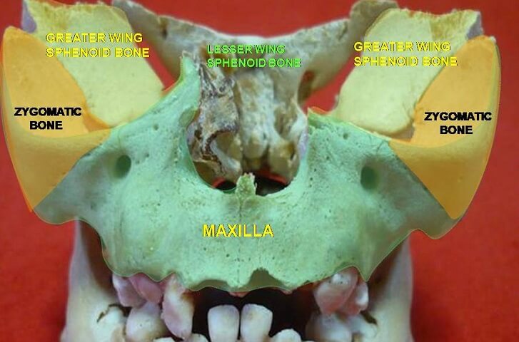 lesser wing wings sphenoid bone maxilla