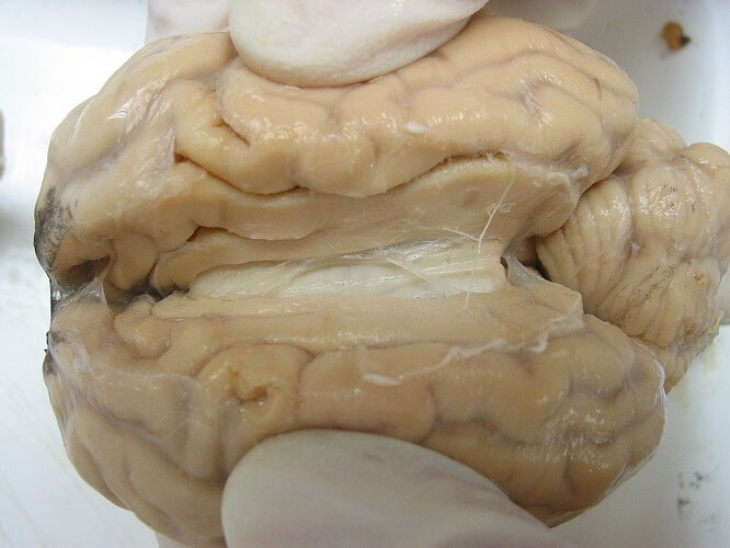 longitudinal fissure sheep brain